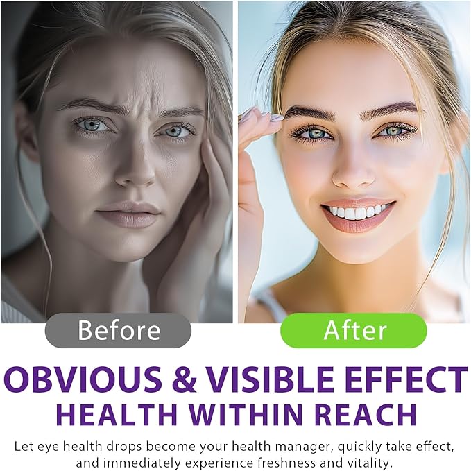 Eyebright Herb Eye Health Drops
