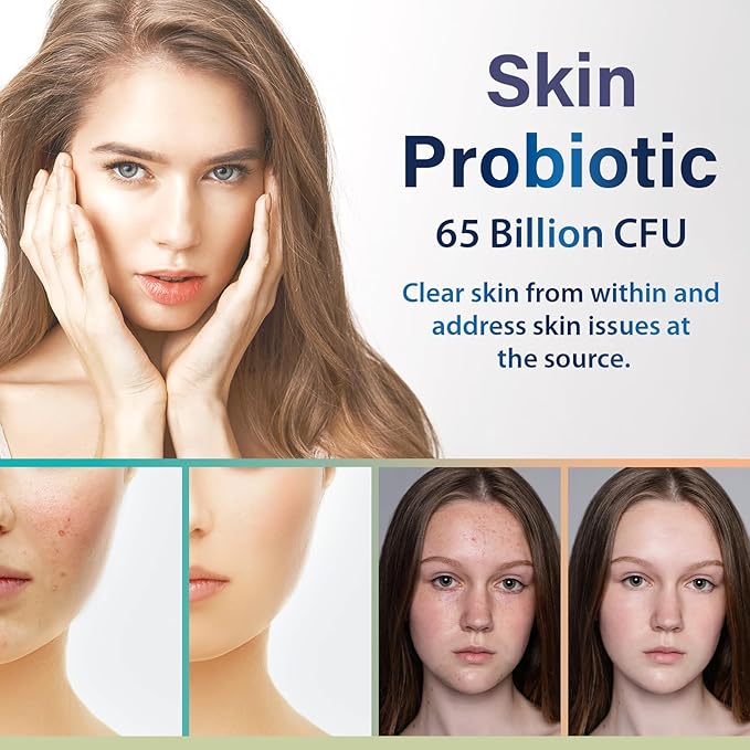 Beauty Probiotics for Women, Collagen Boost with 3-in-1 Complete Prebiotics, Postbiotics & Probiotics for Hair, Skin, Nails & Vaginal Health - 65 Billion CFU, Ceramides, Resveratrol & CoQ10, 60 Caps