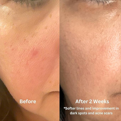 Luster Bakuchiol Oil Serum, Retinol Alternative, Anti-Aging, Superfood Face Oil with Bakuchiol, Astaxanthin, Rosehip Oil, Meadowfoam Oil, Squalane, Pomegranate Oil for the Face, Natural Skincare